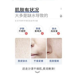 Bán Chạy Đặc Biệt#现货抖音伊渼雅同款欧丝韵维E甘油保湿护肤锁水妆前补水防干燥起皮#正品7. 5yy