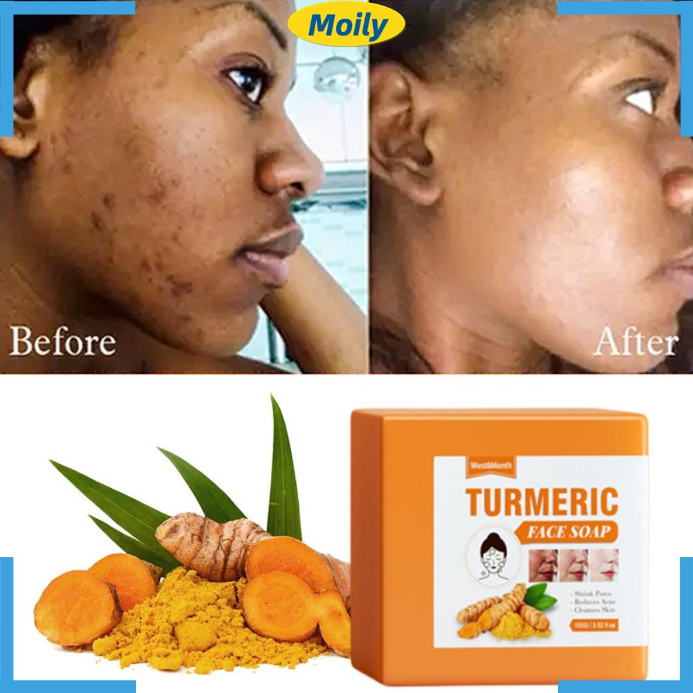 MOILYVN Xà Phòng Rửa Mặt Tẩy Tế Bào Chết Làm Sạch Sâu Dưỡng Ẩm Loại Bỏ Đốm Đen