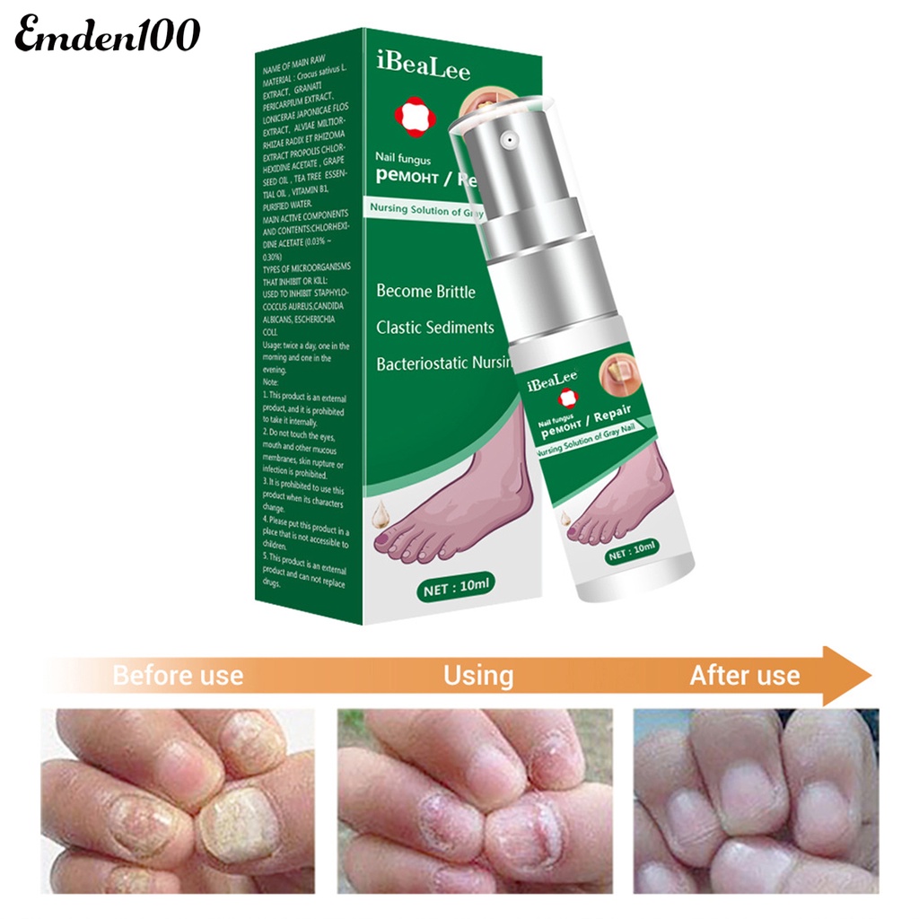 Dung Dịch Kháng Khuẩn 10ml Dễ Sử Dụng Cho Chăm Sóc Móng Tại Nhà