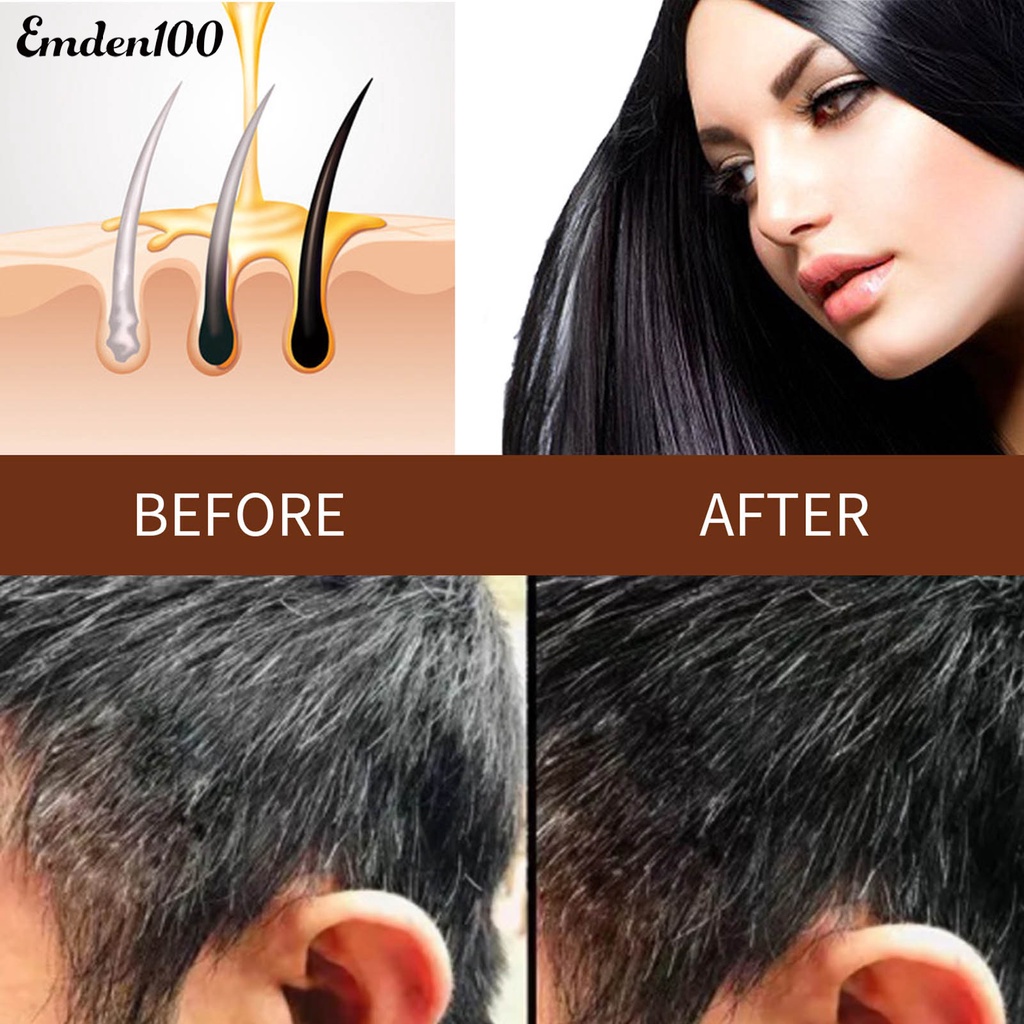 Xà Phòng Gội Đầu Chống Kích Ứng Nhanh Chóng Tiện Lợi Cho Người Lớn