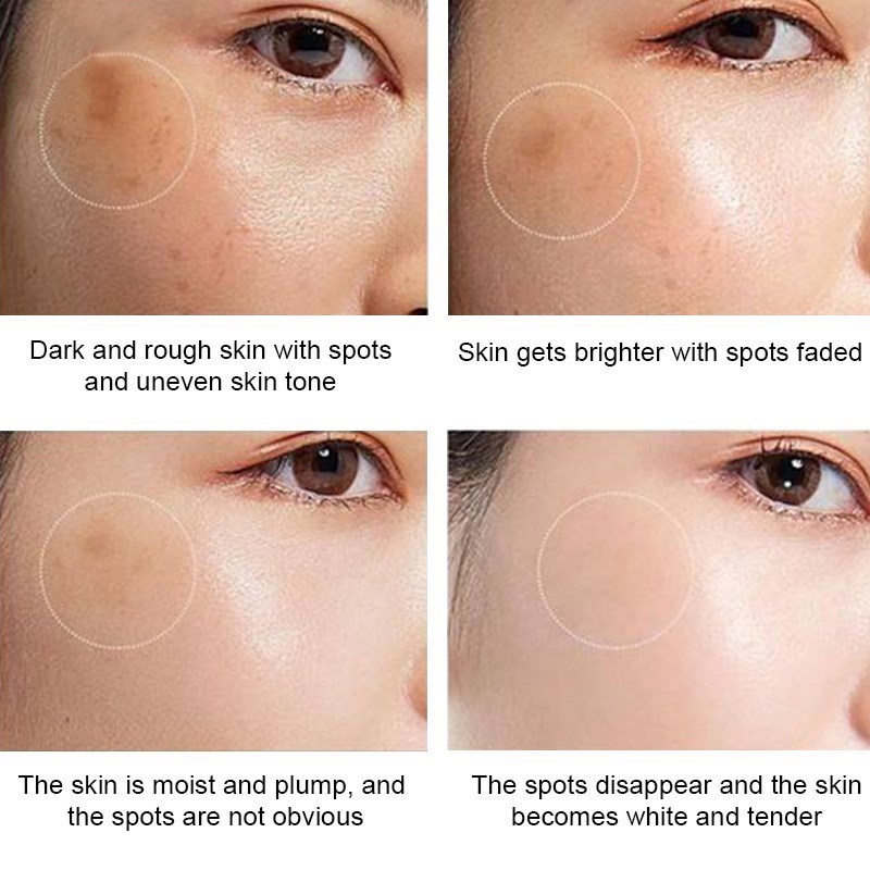 Serum HOUMAI 50ml Làm Trắng Xóa Tàn Nhang Và Chống Lão Hóa Da