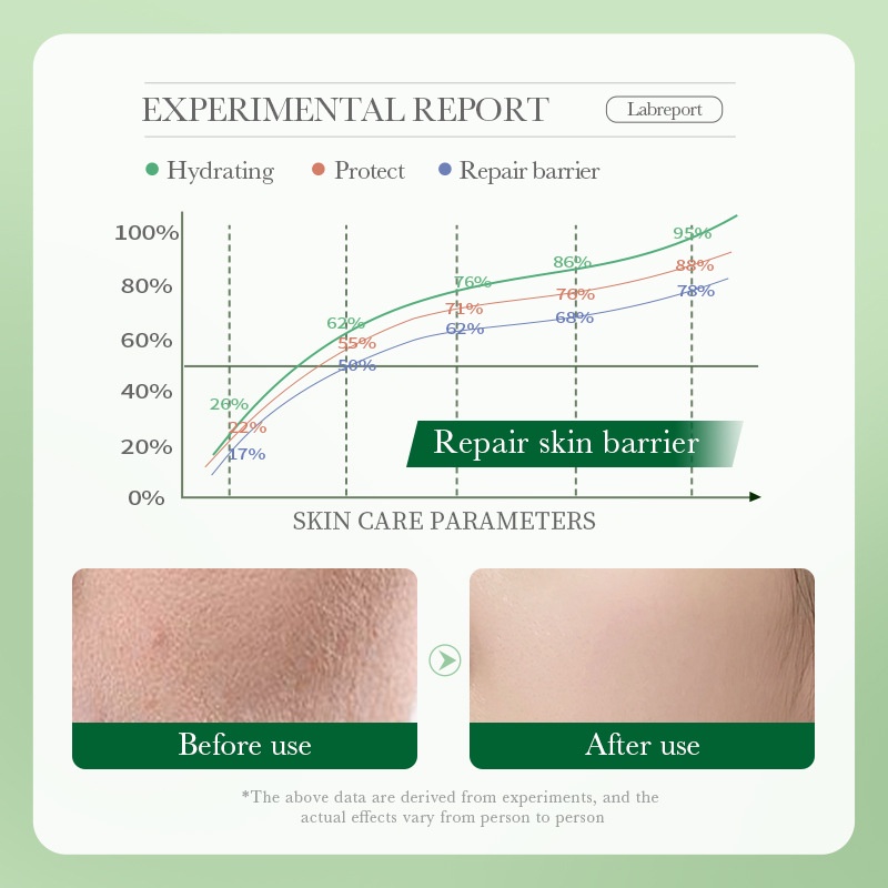 Bioaoua centella Asiatica Facial Moisturizer lotion dưỡng ẩm cho da khô da nhạy cảm có sẵn 80ml