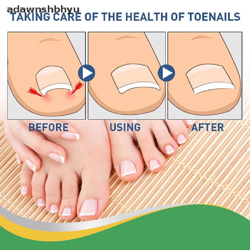 Set 50 Miếng Dán Chỉnh Sửa Móng Chân Tiện Dụng