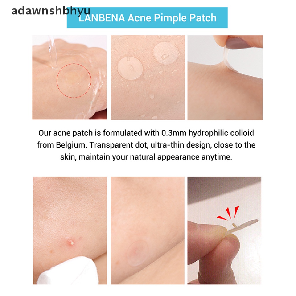 Miếng Dán Hỗ trợ giảm mụn Vô Hình Chăm Sóc Da Mặt