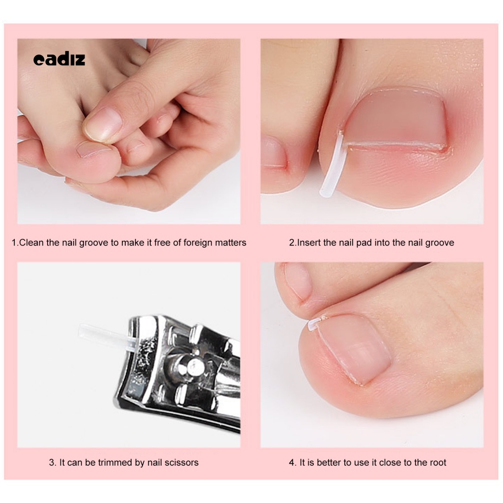 Set 10 Miếng Dán Chỉnh Sửa Móng Chân Tiện Dụng