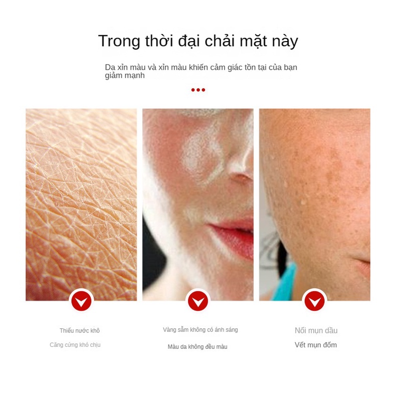 Tinh Chất Dưỡng Ẩm Làm Trắng Da 100ml Loại Bỏ Tàn Nhang Mụn Trứng Cá