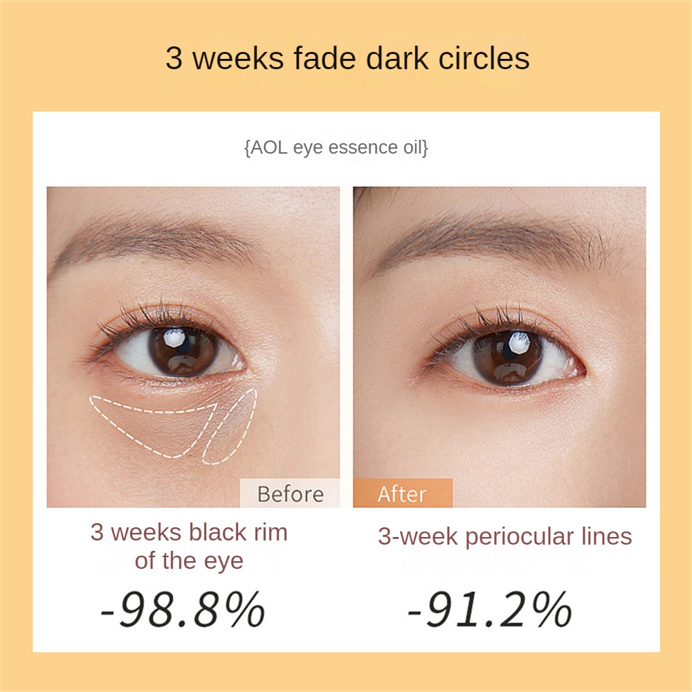 Skik Set 3 Thanh Lăn Tinh Dầu Làm Săn Chắc Da Mắt Chống Nếp Nhăn Và Quầng Thâm