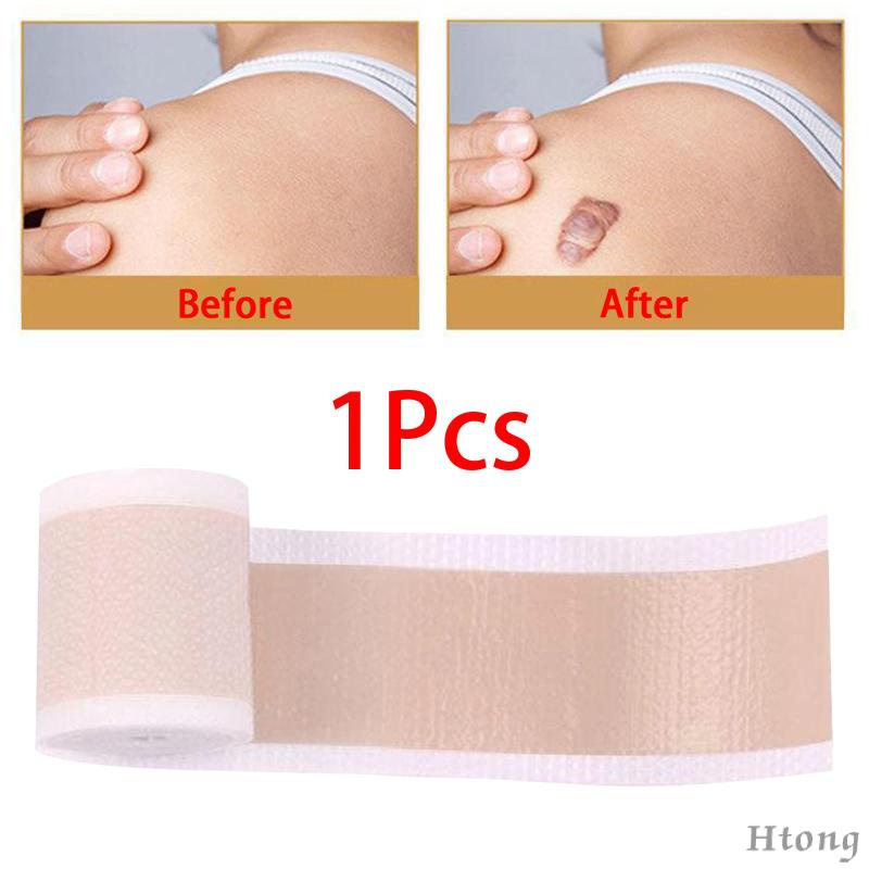 Cuộn Băng Keo Silicone Làm Mờ Sẹo