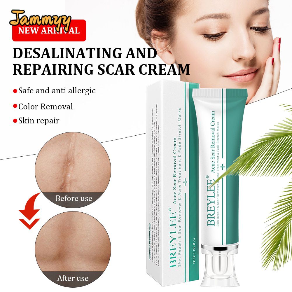 Jammy Breylee Gel Xóa Sẹo Kem Trị Sẹo Sẹo Mụn 30g Sửa Chữa Da, Giảm Vết Rạn Da, Xóa Sẹo Và Ngăn Ngừa Sẹo Làm Sáng Sâu Sẹo Mụn Chăm Sóc Da