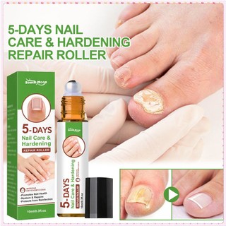 South moon chăm sóc móng & làm cứng móng 5 ngày con lăn chống nấm nuôi dưỡng móng giải pháp điều trị thảo dược tự nhiên chăm sóc cơ thể 10ml togo