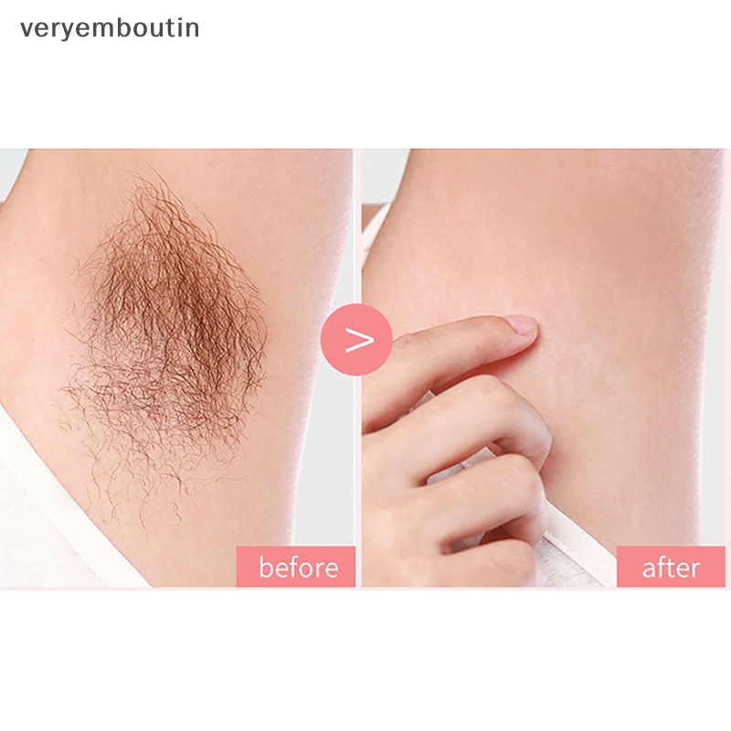 Máy Tẩy Lông Cơ Thể Không Đau Cho Nữ