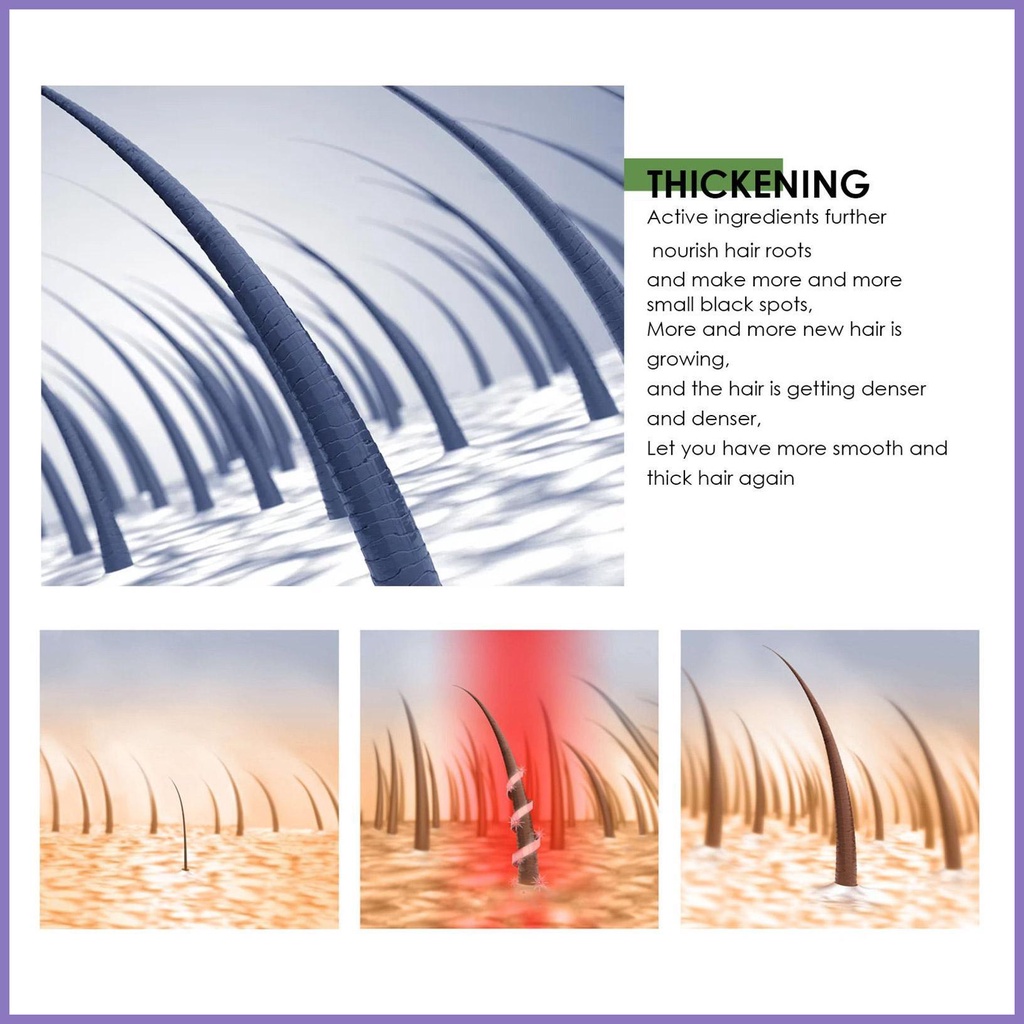 Tinh Chất Kích Thích Mọc Tóc Và Nuôi Dưỡng Tóc Khô Hư Tổn Dr nota2vn