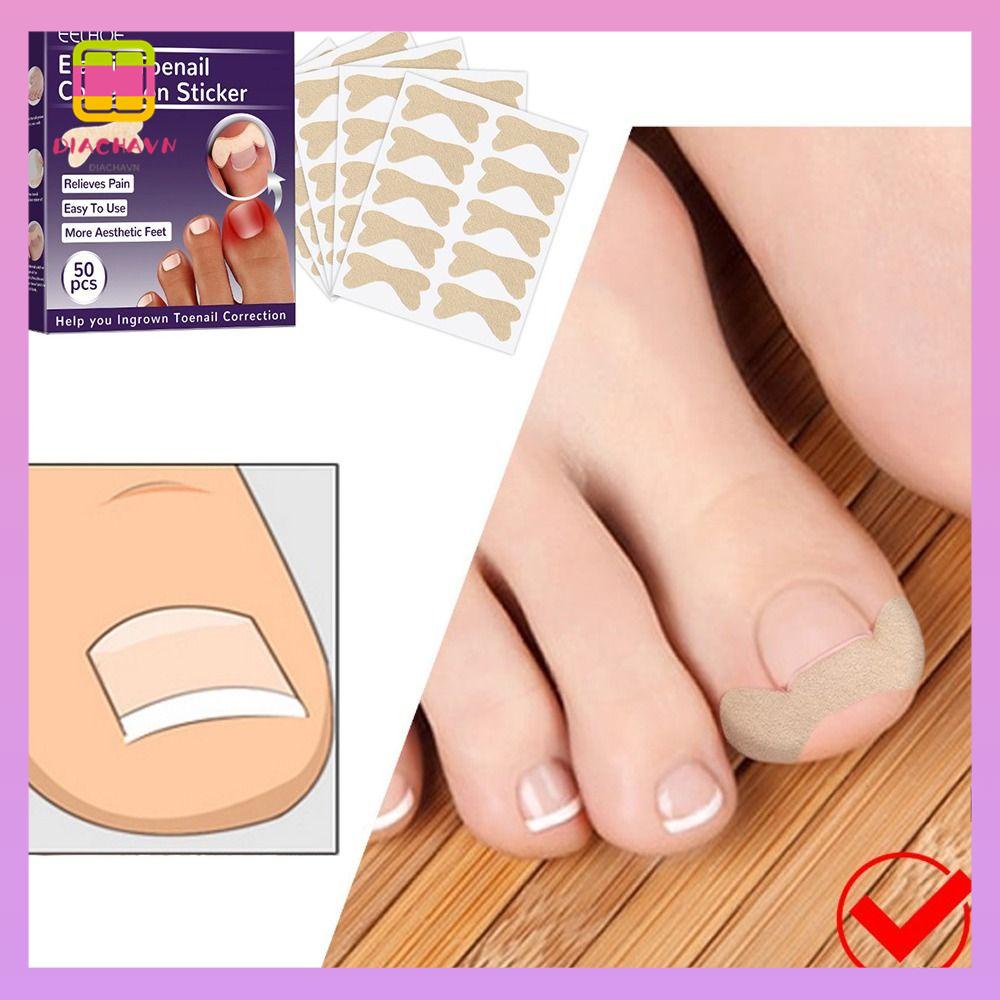 DIACHAVN Set 2 Miếng Dán Chỉnh Sửa Móng Tay Chân Tiện Lợi