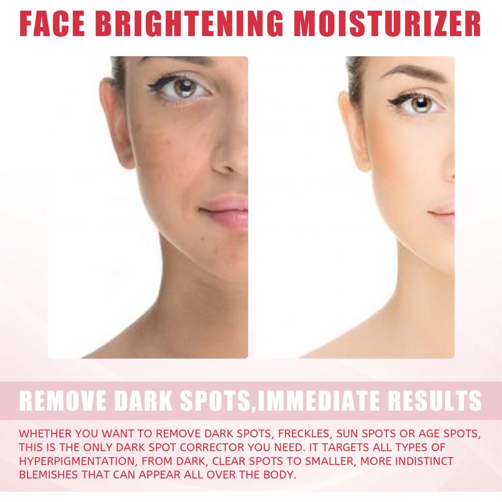 Eelhoe 3 Days Kojic Acid Whitening Moisturizing Cream Black Spot Repairing Cream Body Cream Removing Black Spots Depigmentation Brightening Moisturizing 25g