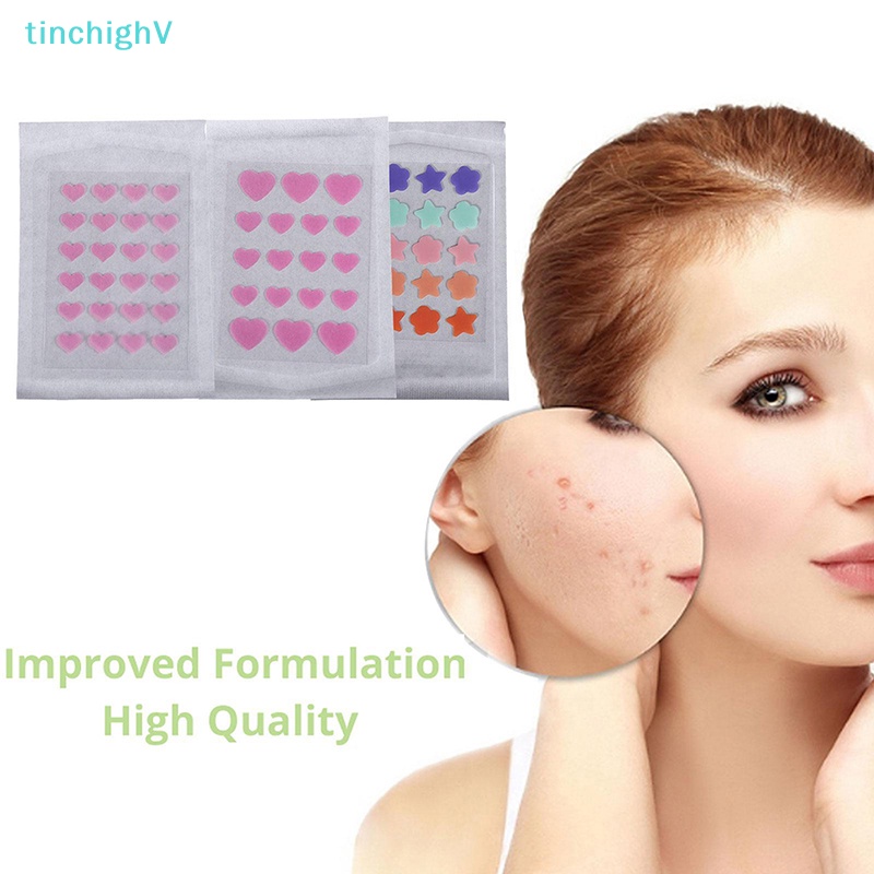 Set 20 / 24 Miếng Dán Mụn Màu Sắc Vô Hình
