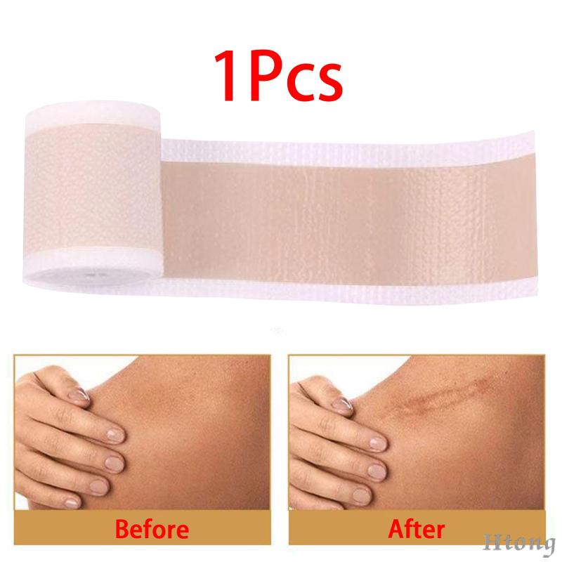 Cuộn Băng Keo Silicone Làm Mờ Sẹo