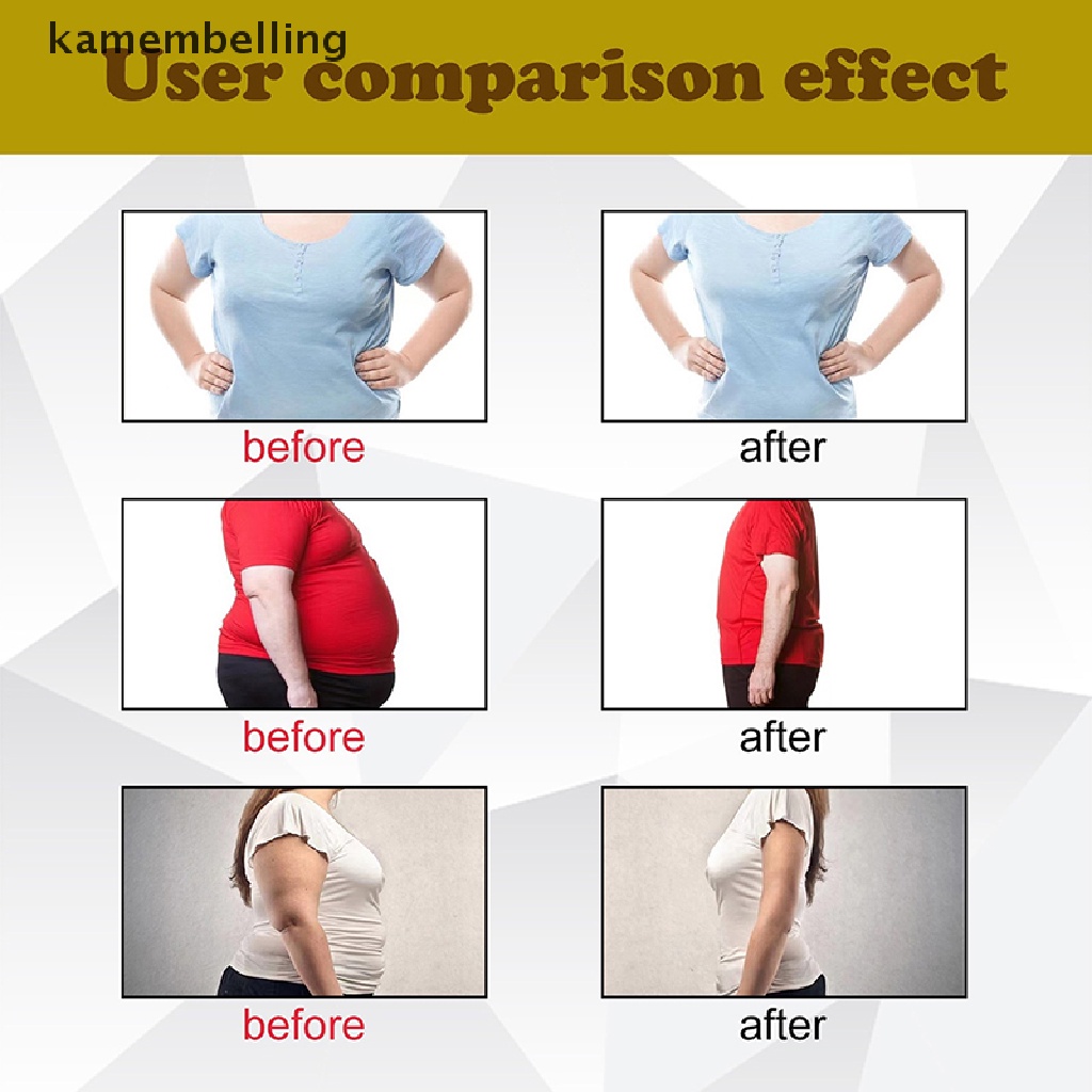 Kamembelling 1 Băng Đeo Cổ Tay Thể Thao Unisex Bằng Nylon Có Thể Điều Chỉnh Giảm Đau