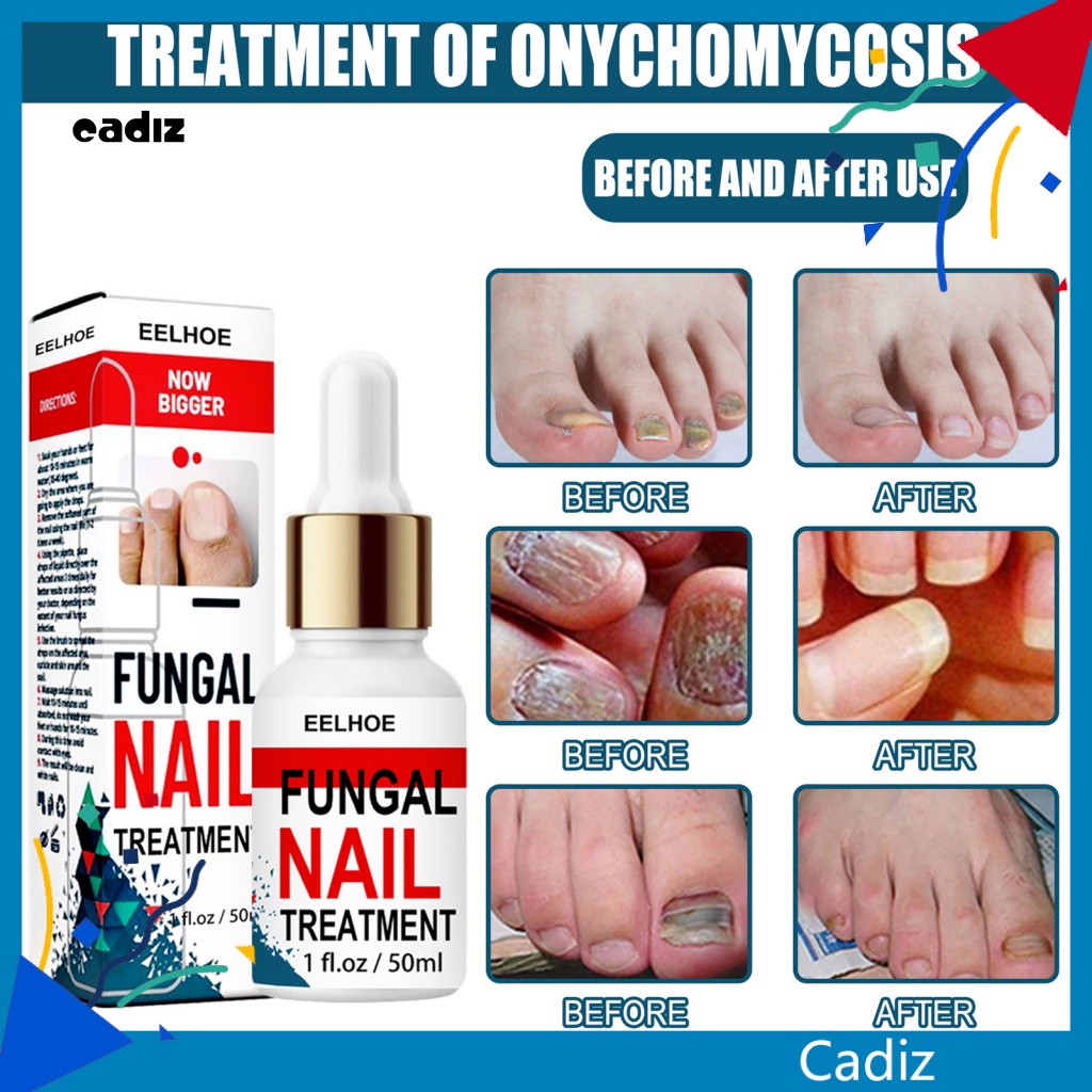 Tinh Dầu Chăm Sóc Móng Tay Bị Hư Tổn Đa Năng Tiện Lợi Dành Cho Salon