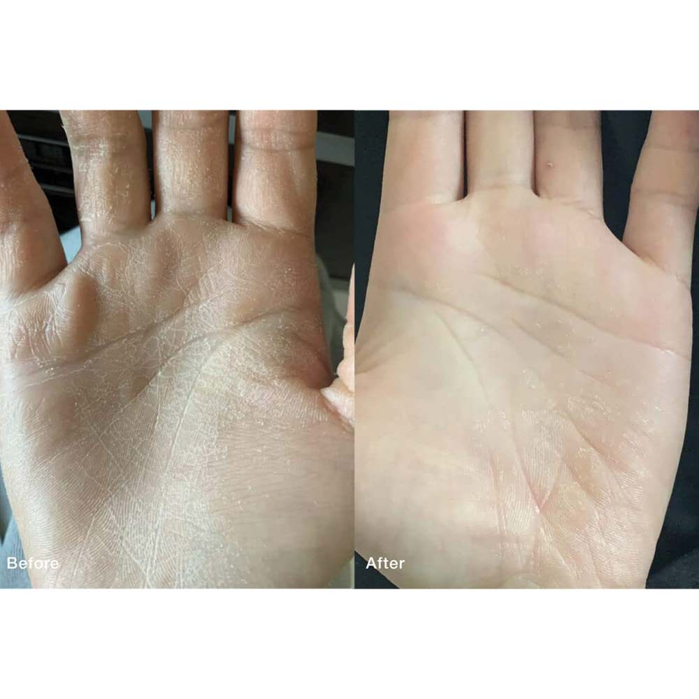 DU'IT Tough Hands Emergency Hand Mask Dead Skin Protection Cream 150g