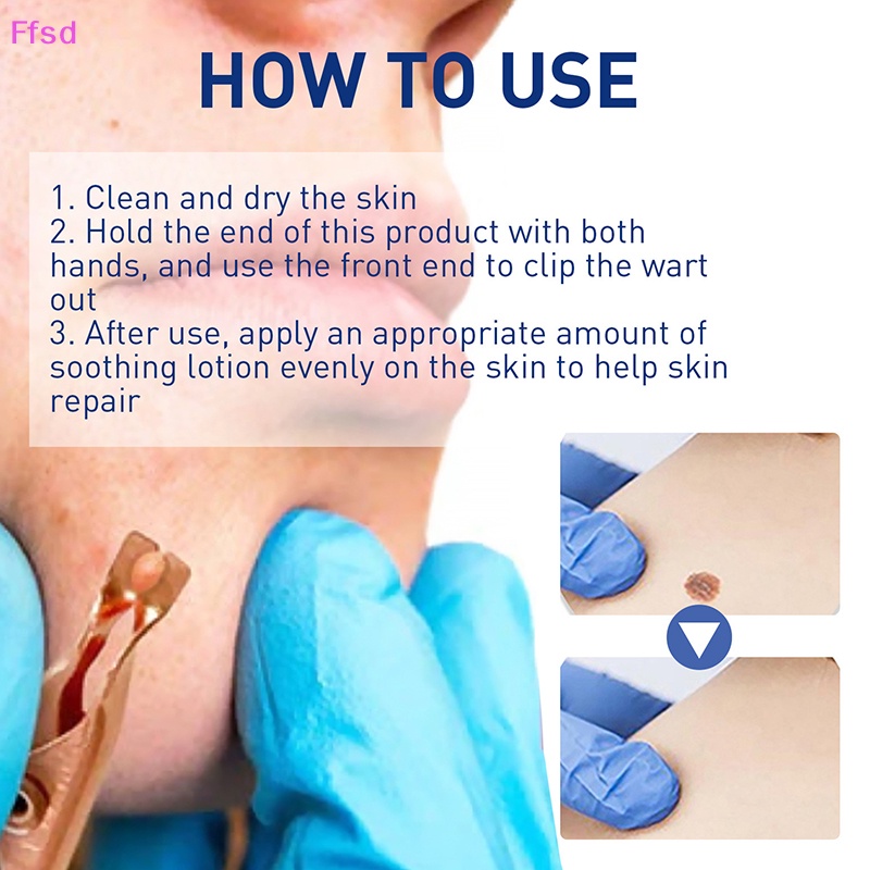 1 Dụng Cụ Kẹp Nhỏ Bằng Đồng Loại Bỏ Mụn Thịt Xăm Hình