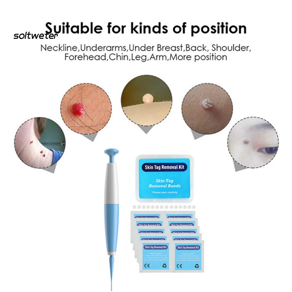 1 Bộ Dụng Cụ Loại Bỏ Mụn Cóc An Toàn Không Gây Kích Ứng Nhanh Chóng Thân Thiện Với Làn Da