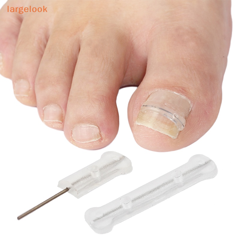 Bộ 10 Miếng Dán Chỉnh Sửa Móng Chân 13-20mm