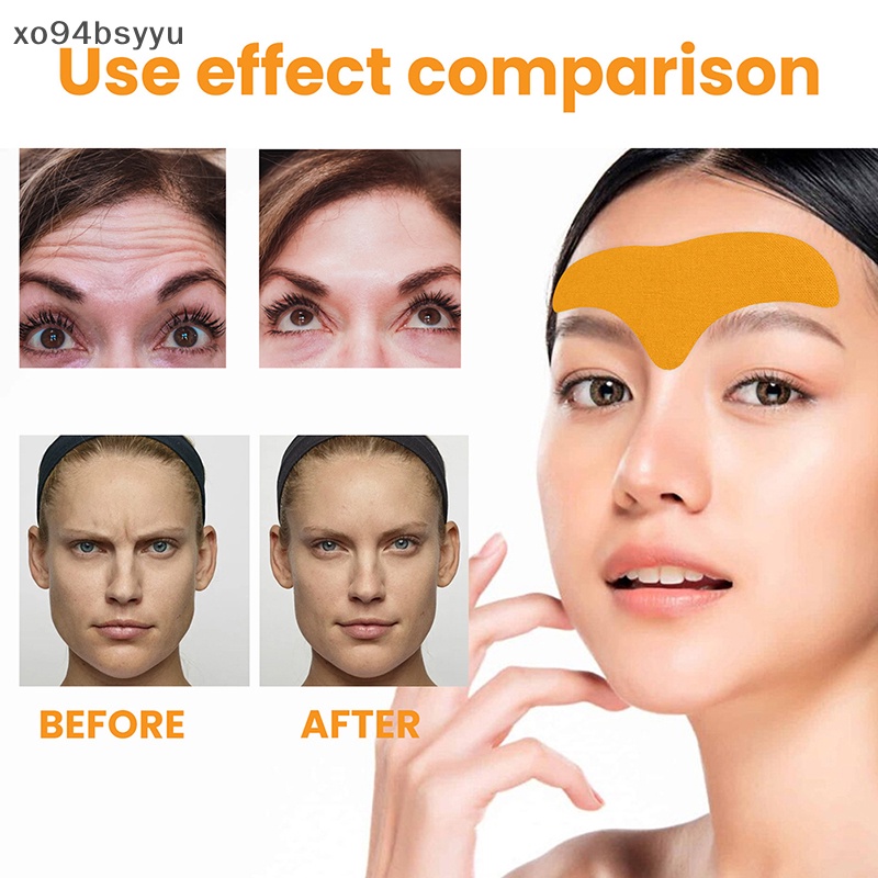 Set 10 Miếng Dán Loại Bỏ Nếp Nhăn Ở Trán Xo94Bsyu