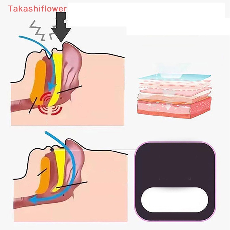 Set 30 Miếng Dán Chỉnh Sửa Lỗ Chân Lông Mũi / Môi Chống Ngáy Khi Ngủ Dành Cho Người Lớn Và Trẻ Em