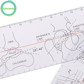 Pairhj multi-ruler goniometer angle ruler joint orthopedics tool instruments vn