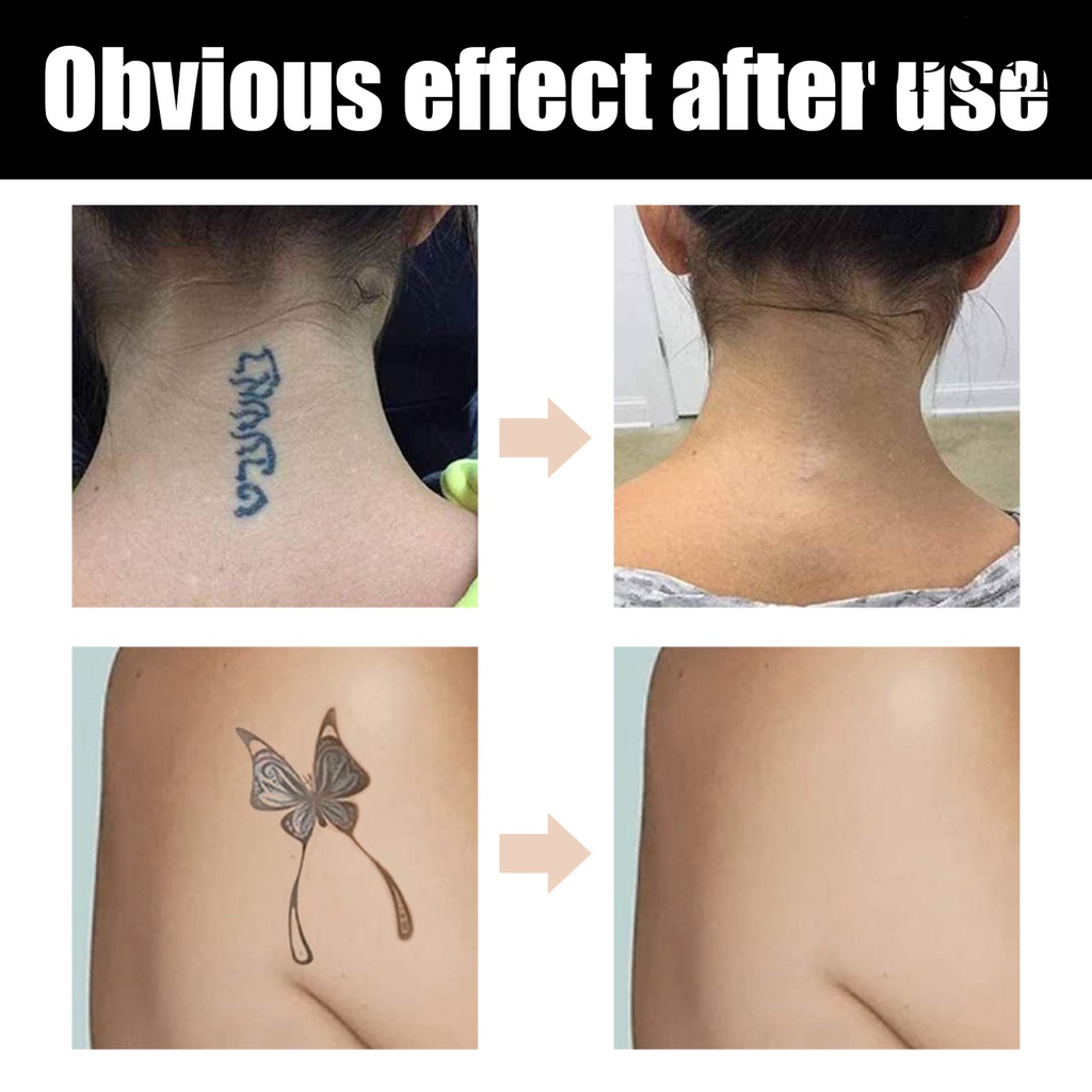 Set 4 Kem Che Khuyết Điểm Hình Xăm 40g Chống Thấm Nước Và Mồ Hôi Lâu Trôi Không Gây Khó Chịu