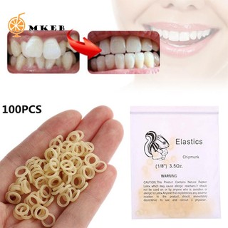 Set 100 Vòng Cao Su Chỉnh Răng Tiện Dụng