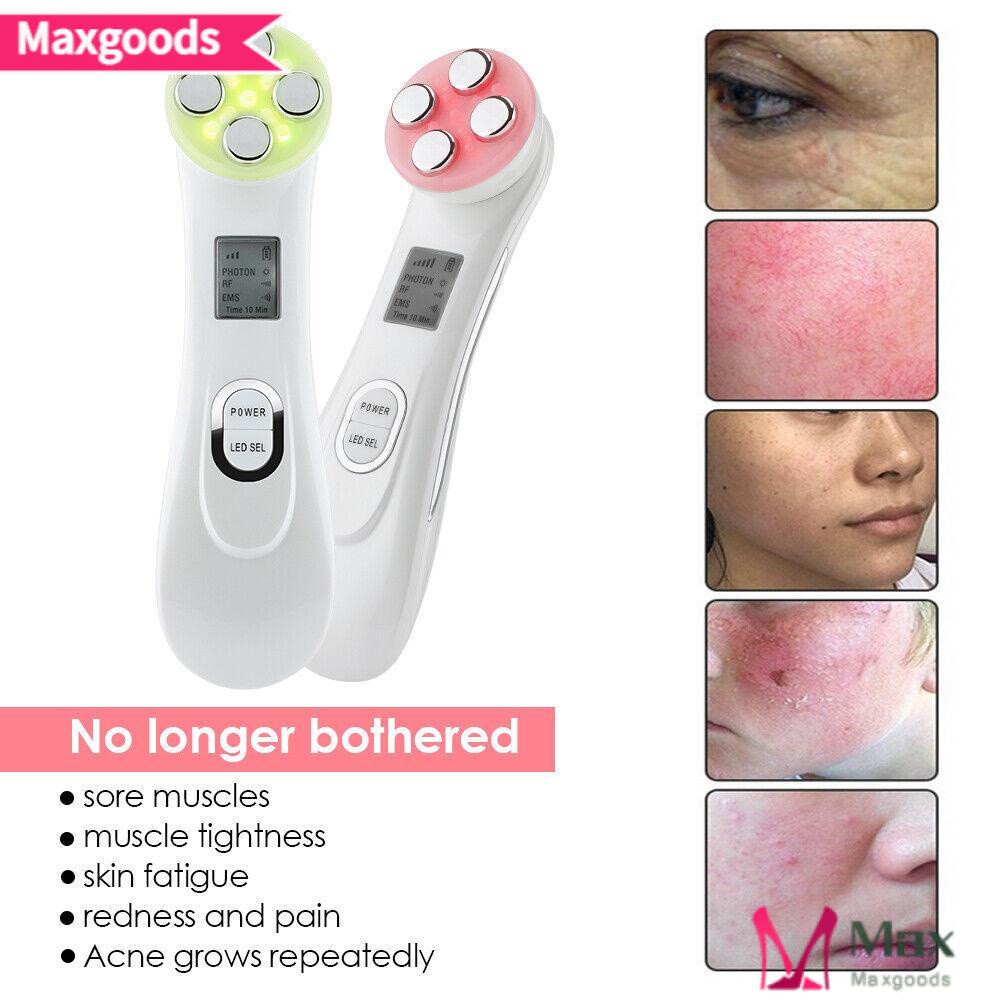 Maxg Máy Phát Thanh Tần Số Vô Tuyến Làm Săn Chắc Da Và Loại Bỏ Tàn Nhang