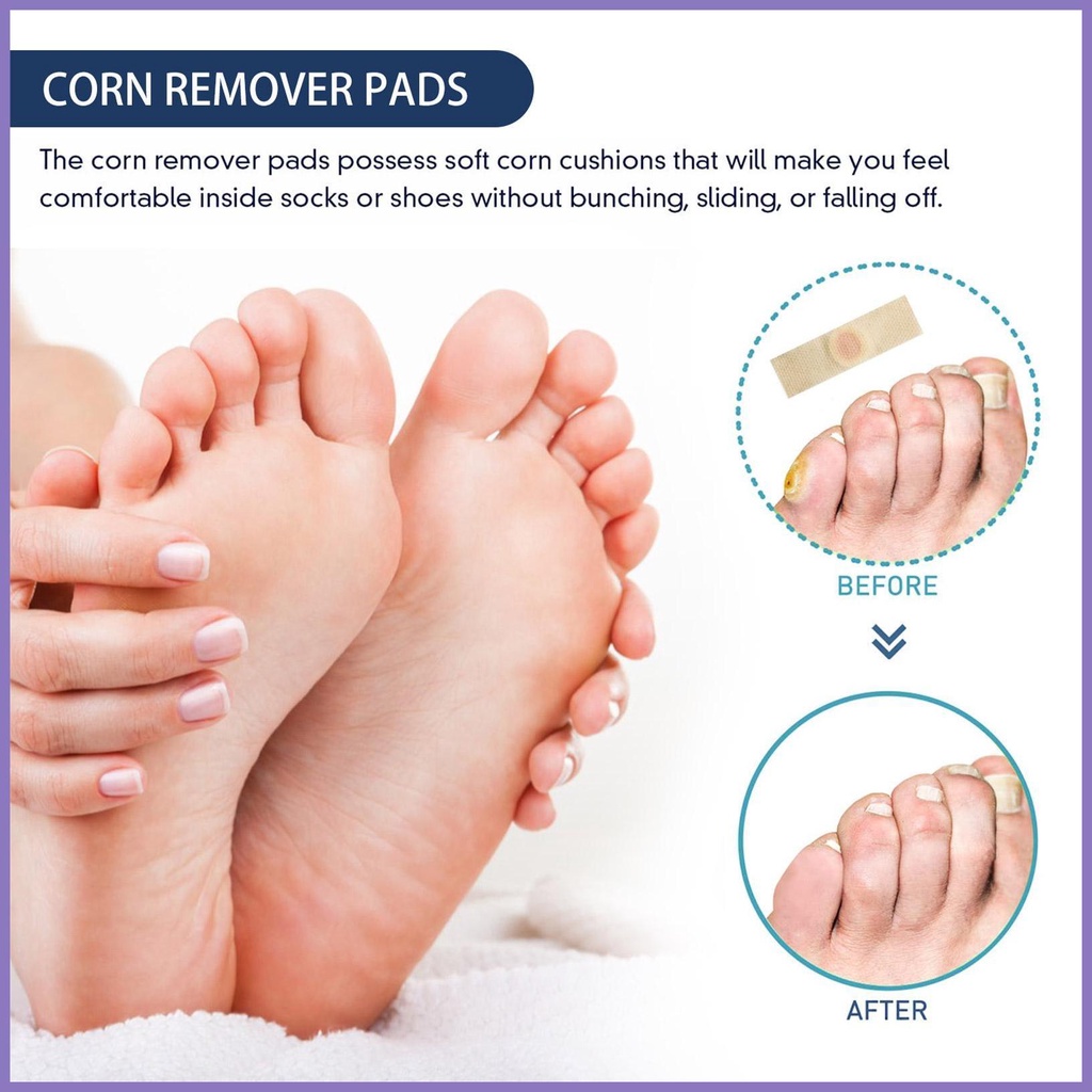 Hộp 24 Miếng Dán Lột Da Chết Chăm Sóc Bàn Chân nota2vn