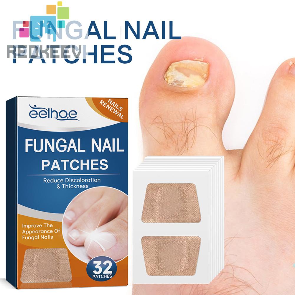 Bộ 32 Miếng Dán Điều Chỉnh Móng Tay Co Giãn Thoáng Khí Dễ Sử Dụng