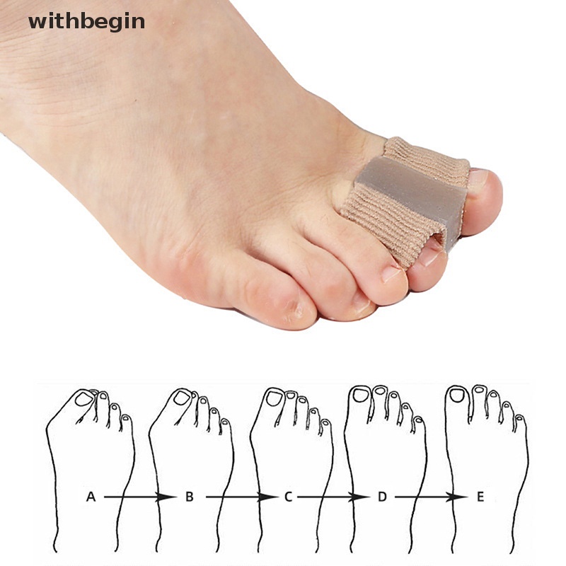 1 Dụng Cụ Tách Ngón Chân Chất Liệu Silicon Giảm Đau Hiệu Quả