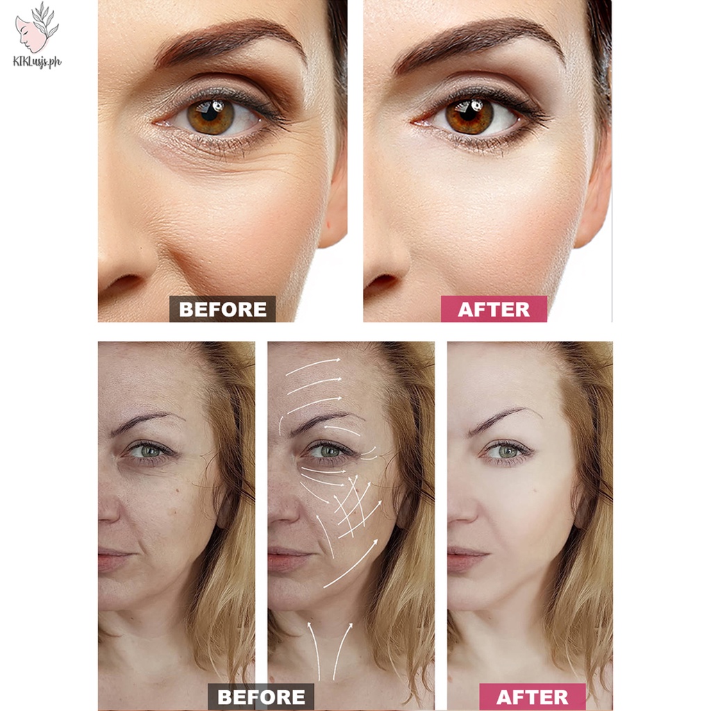 60 Miếng Dán Mặt Mỏng Vô Hình Hình Hình Chữ V Chin Line Sagging Nâng Miếng Dán Mặt Chống Nhăn Da Nâng Băng Facelifting Patch