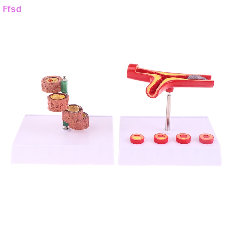 Tượng Vessel Con Người Nối Dài 50 Lần Cho Phòng Thí Nghiệm