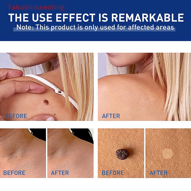 1 Dụng Cụ Kẹp Nhỏ Bằng Đồng Dành Cho Nhãn Da / Thẻ Hình Xăm