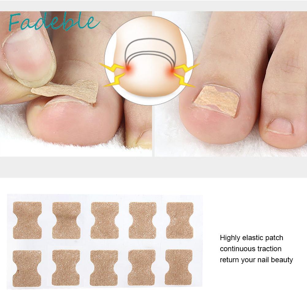 Set 10 Miếng Dán Chỉnh Sửa Móng Chân Tiện Dụng