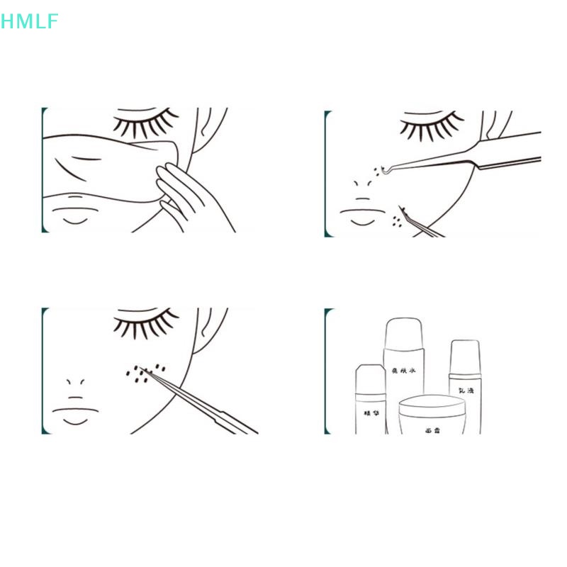 Nhíp Gắp Mụn Đầu Đen Chuyên Dụng Cho Salon Làm Đẹp