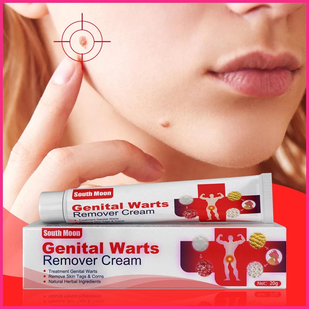 Wart remover ointment cream fast-acting wart remover cream thuốc mỡ loại bỏ mụn cóc hiệu quả và sẹo-free kem buraivn
