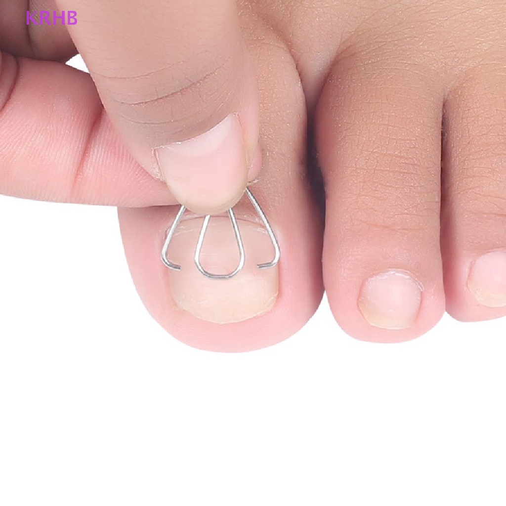 Dụng Cụ Kẹp Chỉnh Hình Móng Chân Mọc Ngược Mới