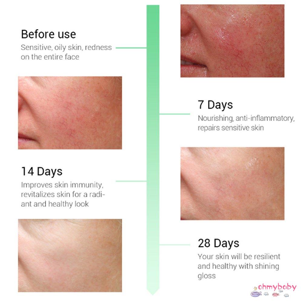 [InStock] Sửa chữa da mặt 15Ml Tinh chất làm dịu Chăm sóc sắc đẹp dưỡng ẩm chống lão hóa Cosmeticliquid [Z/13]