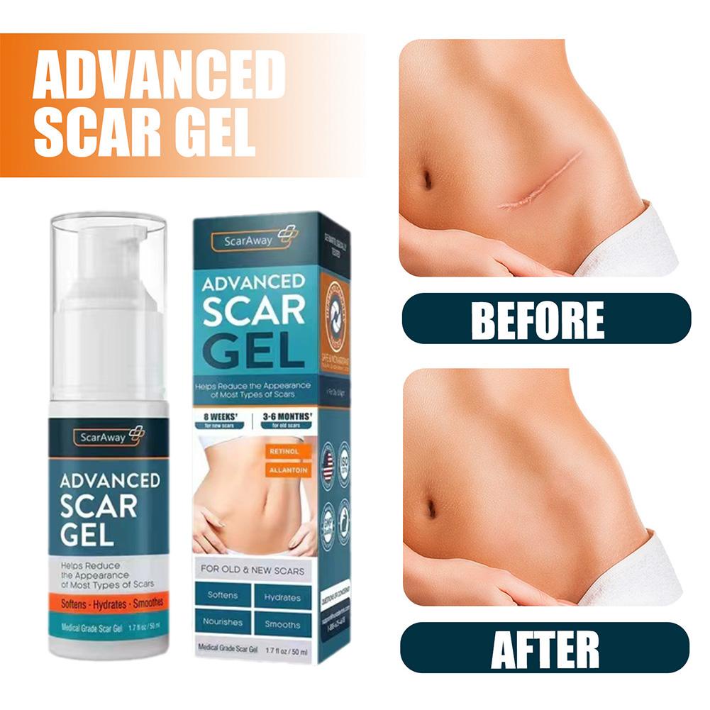 Gel Hỗ trợ giảm sẹo Làm Mịn Da Sau Sinh A3N8