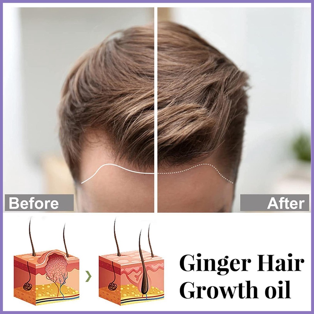 Tinh Chất Kích Thích Mọc Tóc Tái Tạo Tóc Dày Dặn 20ml nota2vn