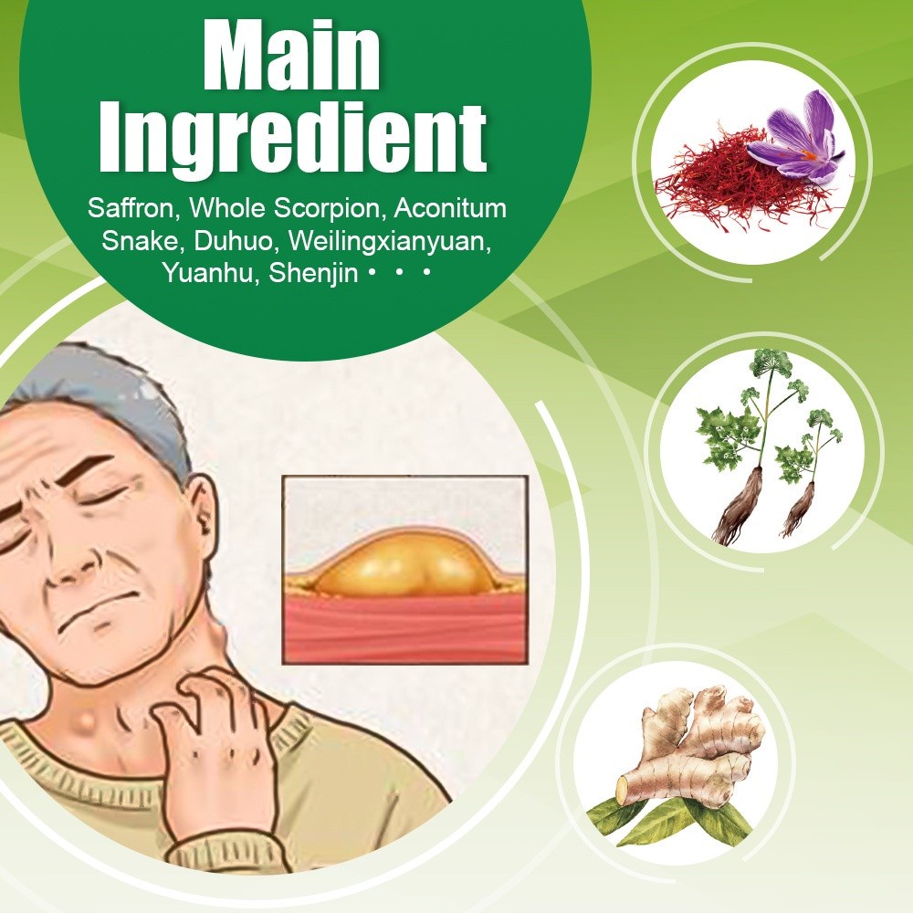 Kem Loại Bỏ Lipoma, Kem Lipoma Loại Bỏ Nhiều Loại Bỏ Dưới Da Đơn Khối Phồng Loại Bỏ Lipoma Nhanh Beautysecret1 beautysecret1