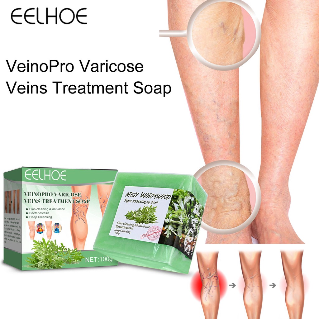 Eelhoe Xà Phòng Sửa Chữa Tĩnh Mạch Chăm Sóc Làm Sạch Chân Xoa Bóp Tĩnh Mạch Giảm Giãn Tĩnh Mạch Sửa Chữa Chân Giun Đất-Ampe