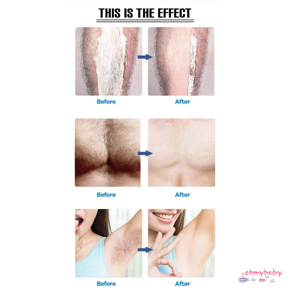 [OMB] Máy tẩy lông Thiết bị nhấp nháy chuyên nghiệp để sử dụng làm đẹp tại nhà Tẩy bền [Z/6]