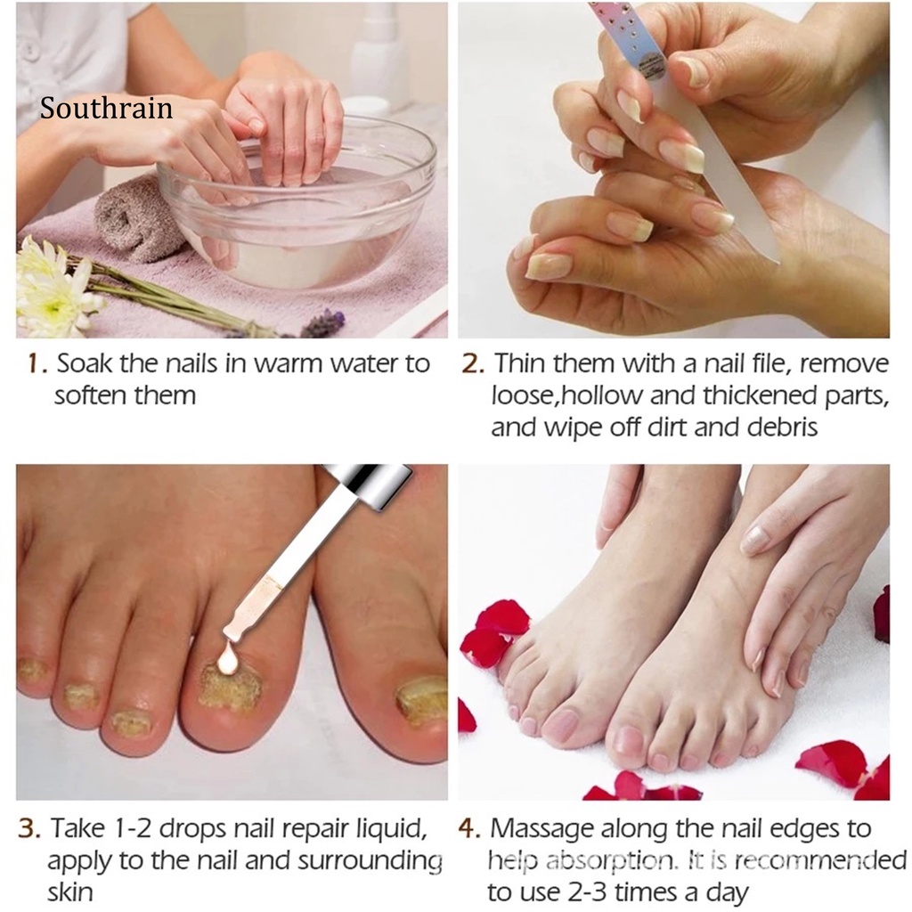 Dung Dịch Kháng Khuẩn 10ml Dễ Sử Dụng Cho Chăm Sóc Móng Tại Nhà