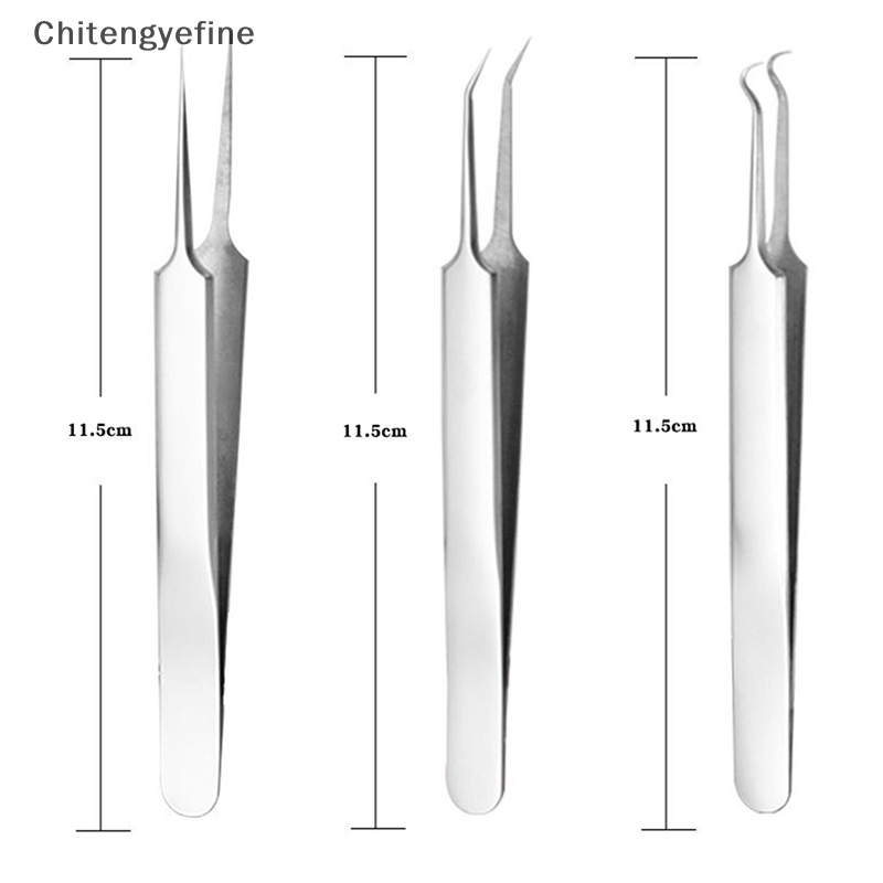 Nhíp Lấy Nhân Mụn Đầu Đen Chăm Sóc Da Mặt Mịn Màng